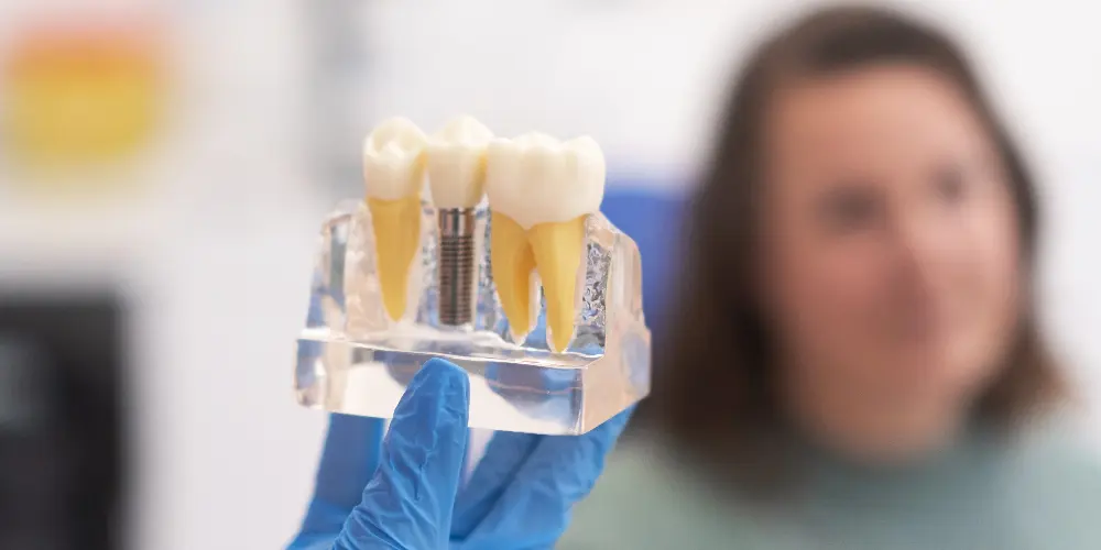 front teeth zirconia crowns