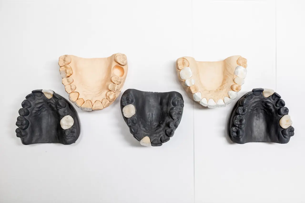 flexible dentures flexible denture repair