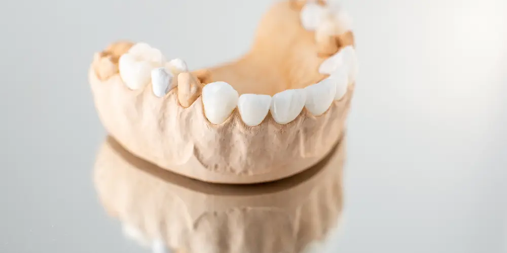 dental restoration dental material dental crowns made of zirconia