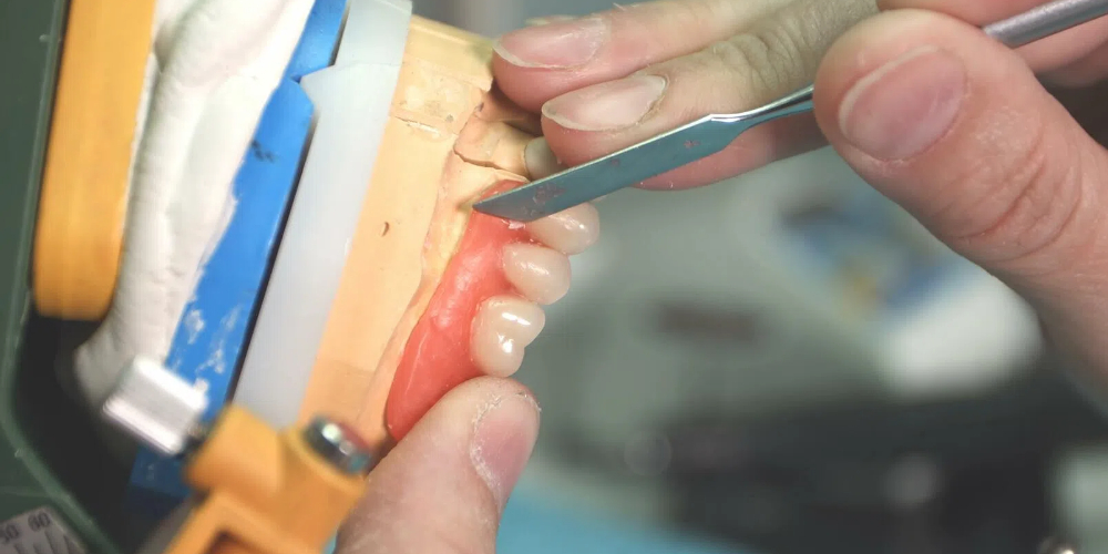 flexible denture repair