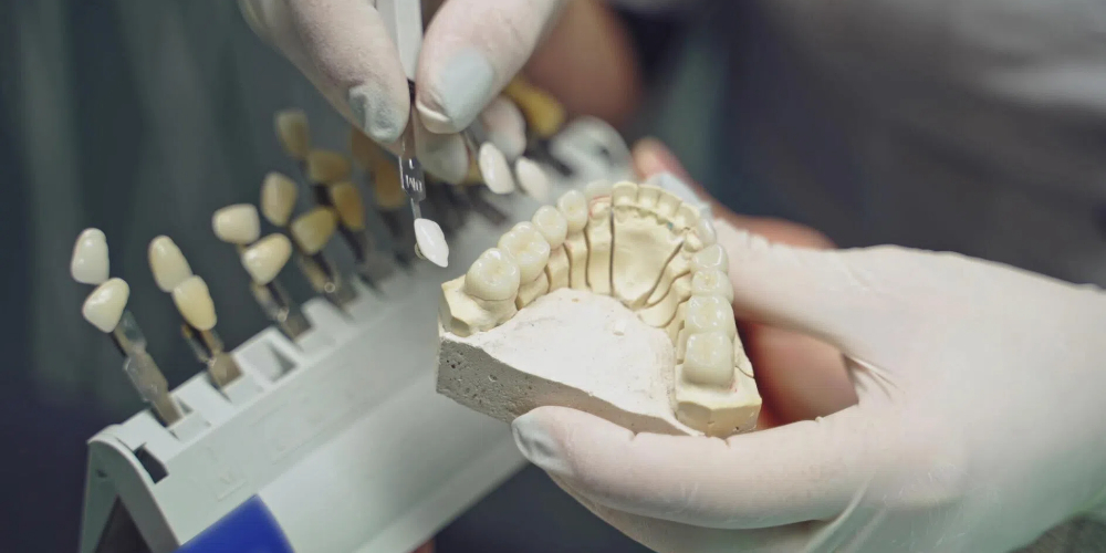 zirconia teeth/tooth