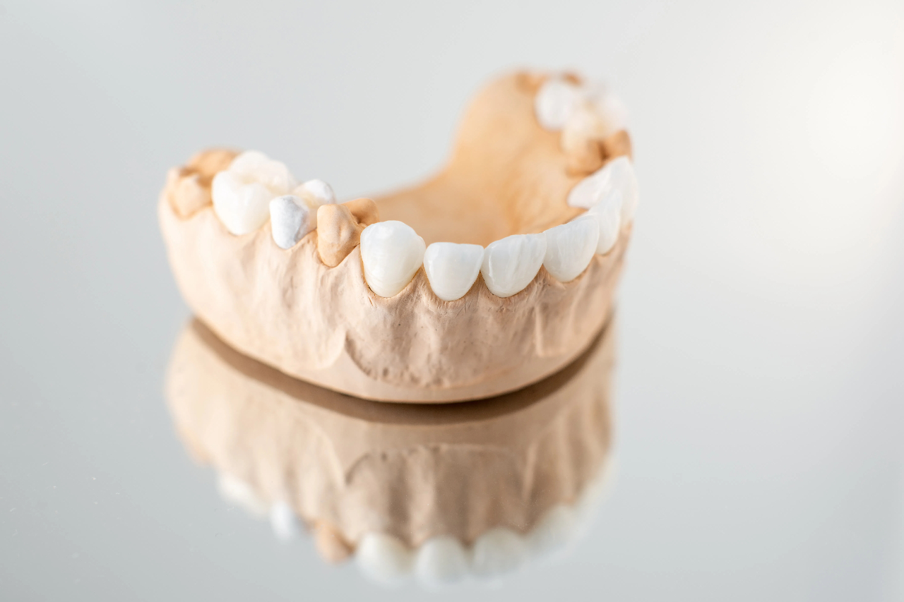 zirconia tooth cap zirconia crown for primary teeth