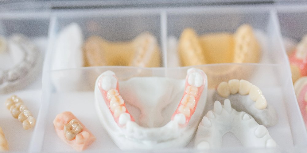full mouth zirconia crowns