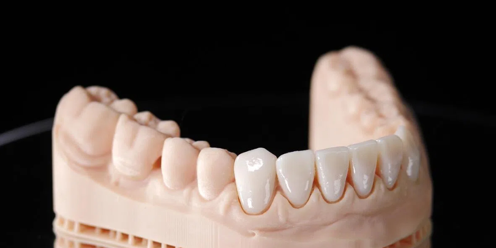 zirconia teeth
