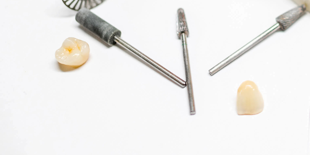 dental restoration