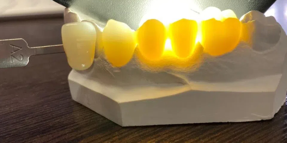 monolithic zirconia
