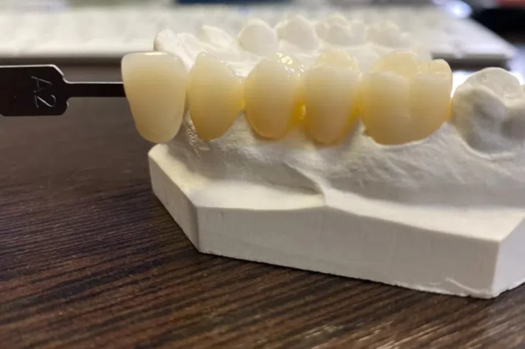 monolithic zirconia