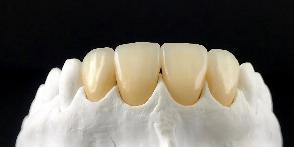 crown teeth zirconia