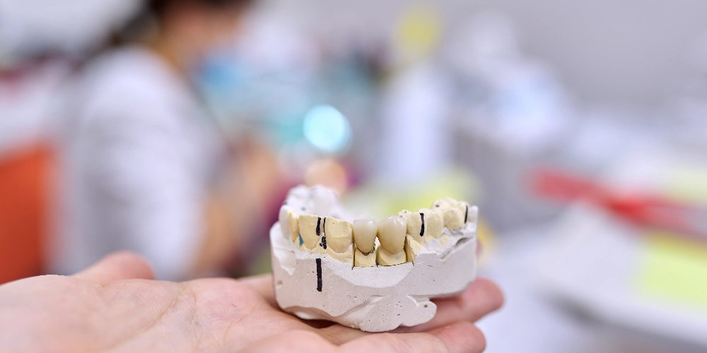 zirconium oxide dental crowns