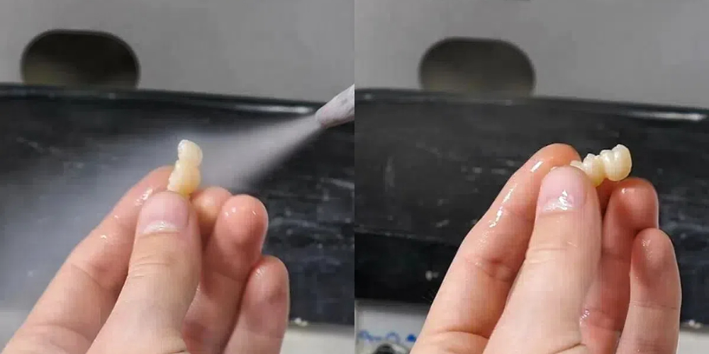 zirconia in dentistry