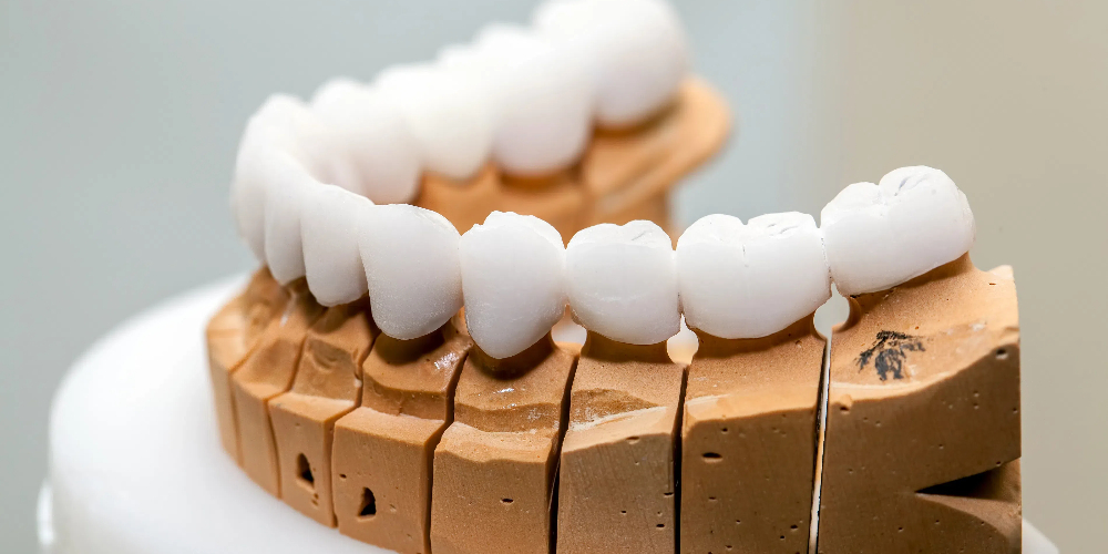 zirconia porcelain crowns