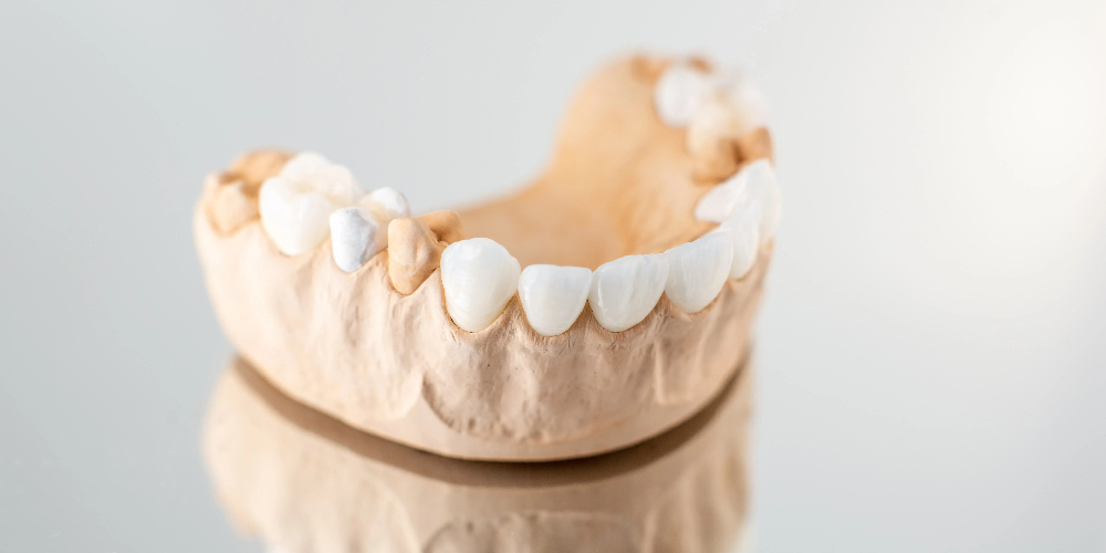 porcelain versus zirconia crowns