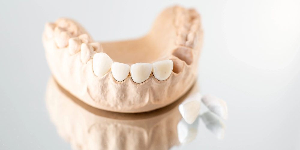 zirconia dental block