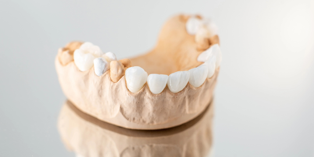 cubic zirconia dental crown