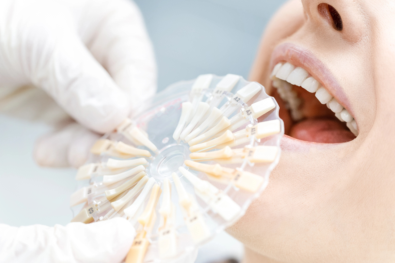zirconia dental crown