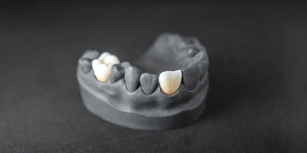 zirconia blocks dental