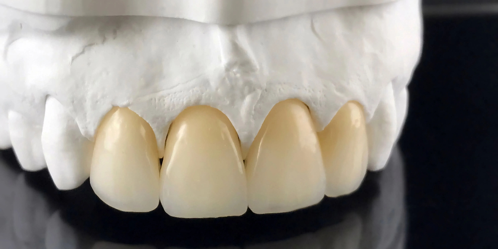 cerec zirconia bridge blocks