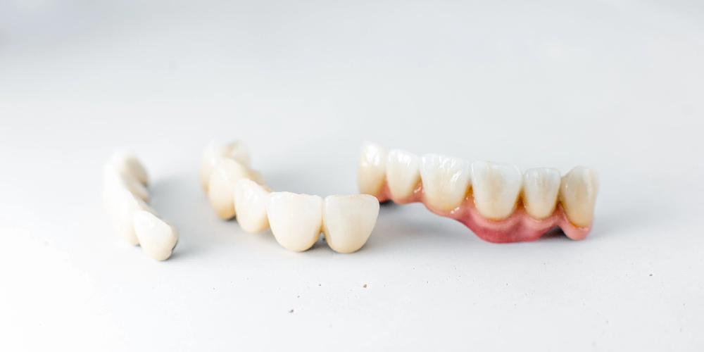 ceramic and zirconia crowns