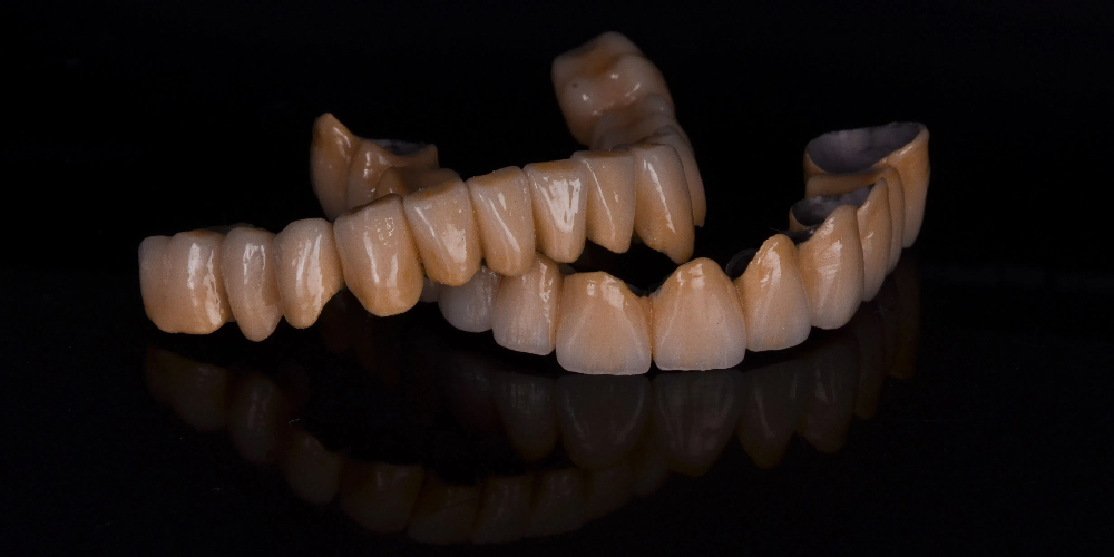 full mouth zirconia crowns