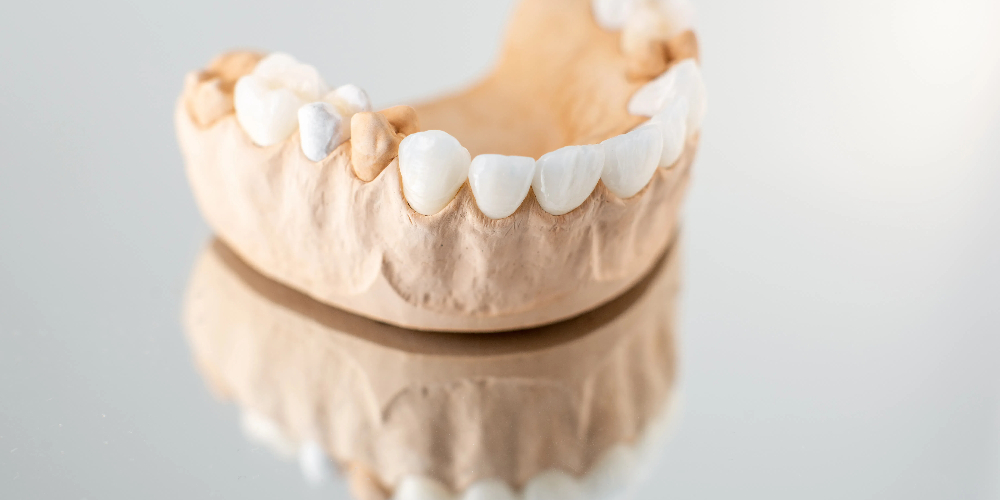 zirconium crowns