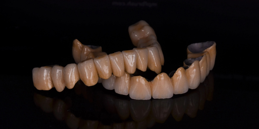 zirconium based porcelain crowns