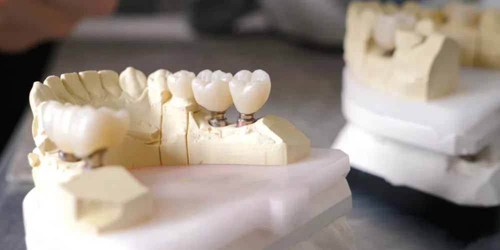 zirconia dental crown