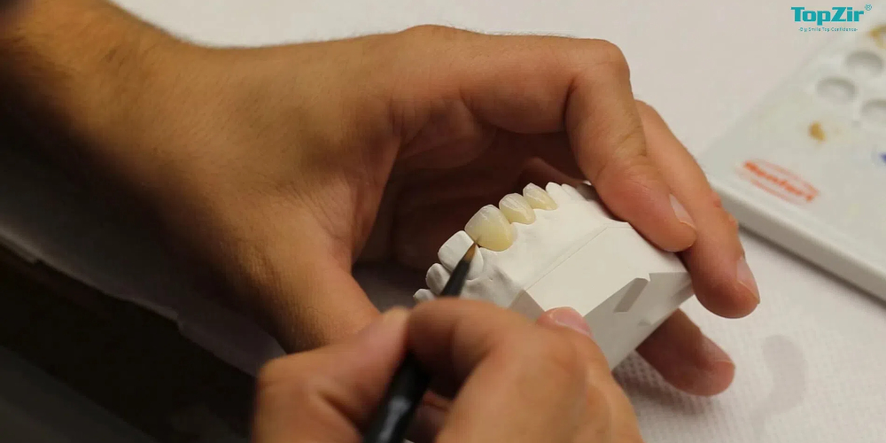 zirconia porcelain crowns