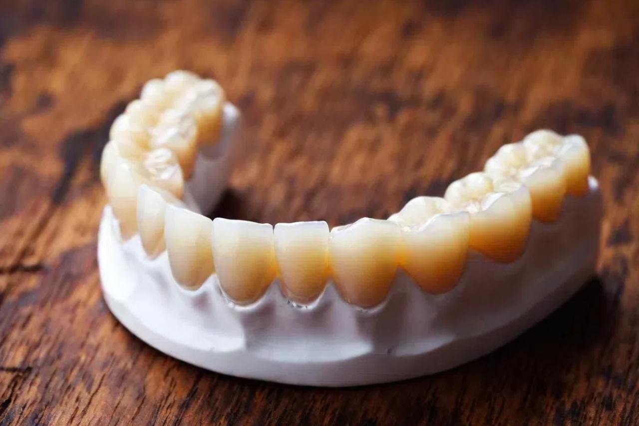ceramic and zirconia crowns