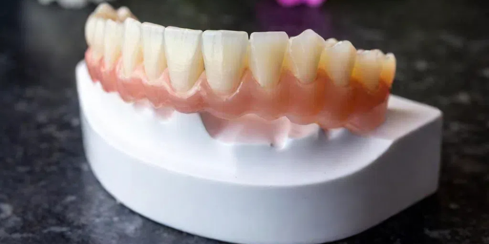 dental zirconia