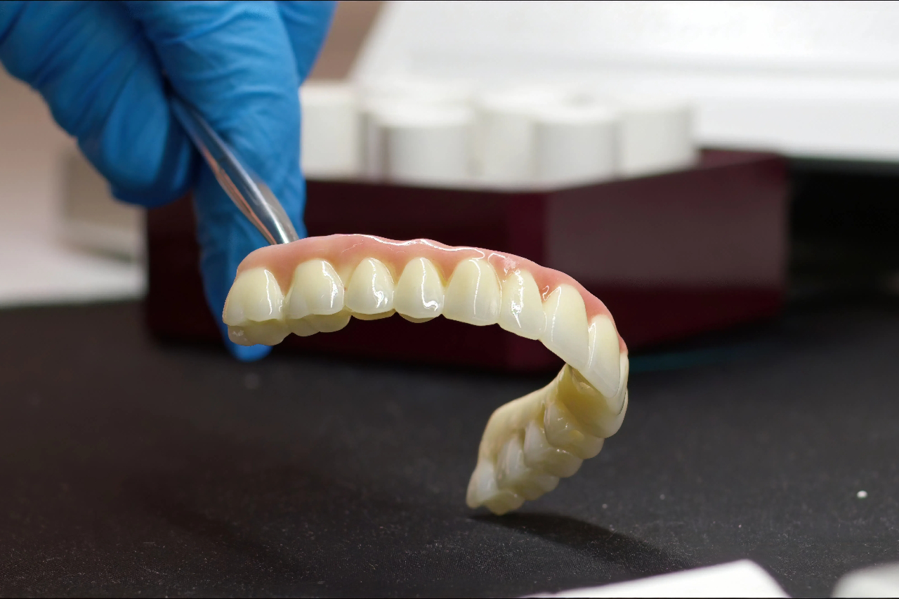 full porcelain crown vs zirconia