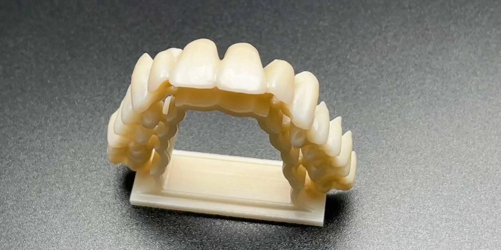 zirconia monolithic crowns review