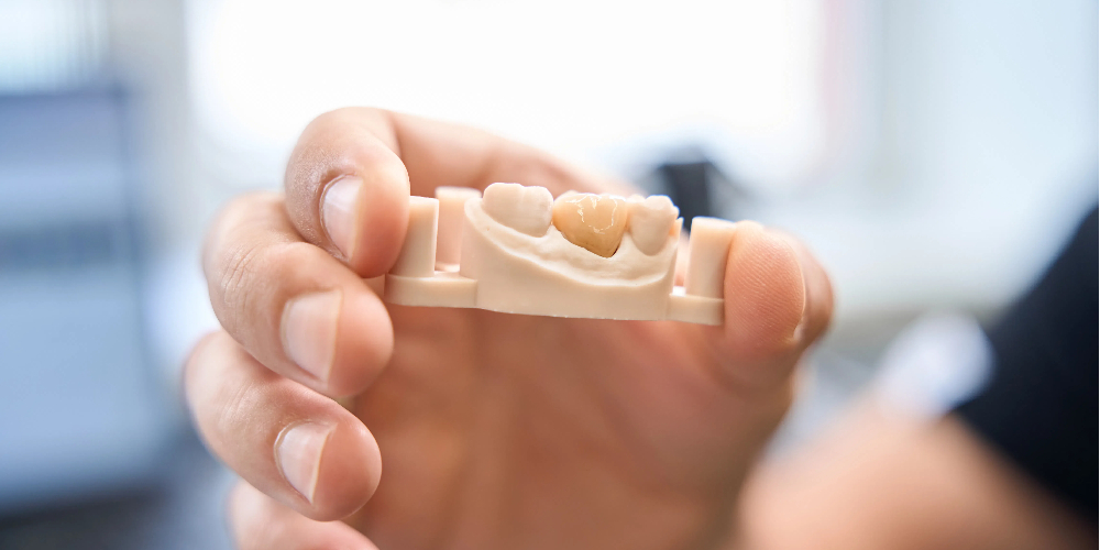 zirconia crowns