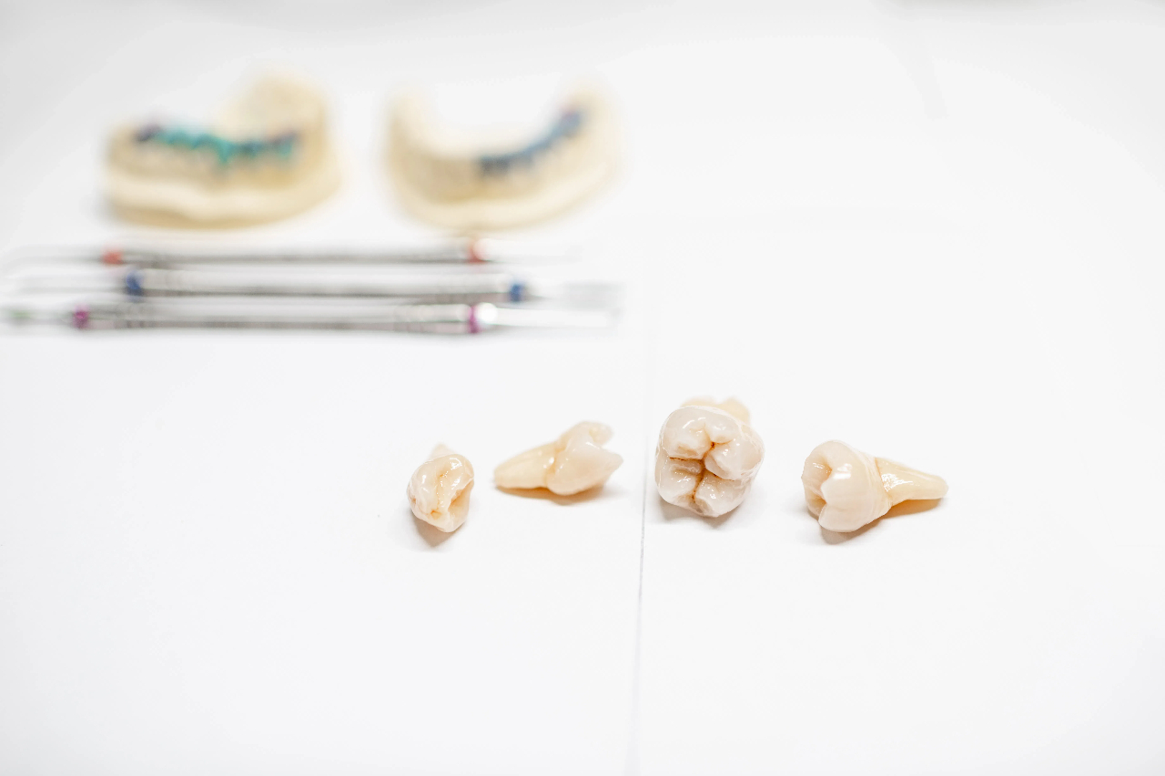layered zirconia crown