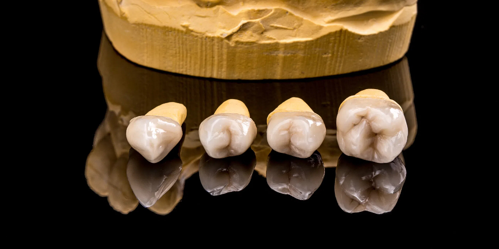 monolith dental crown