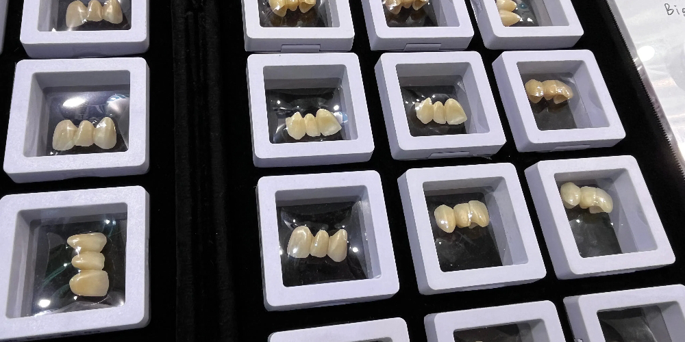 full mouth dental implants