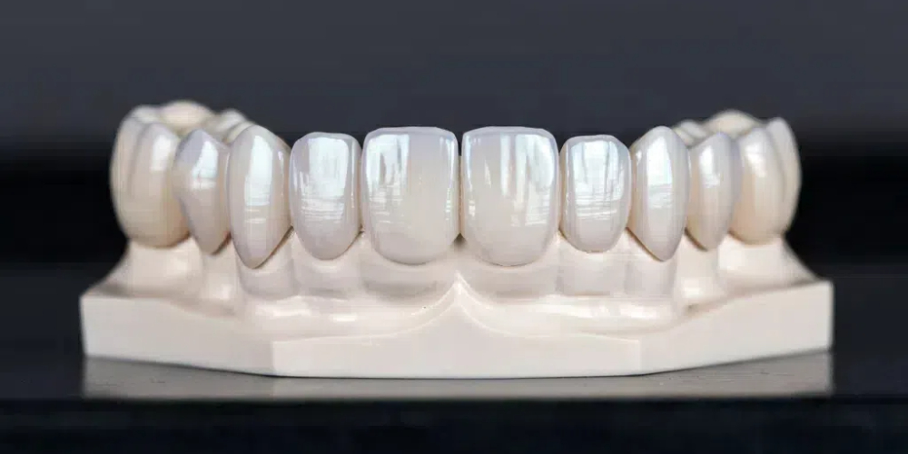 permanent zirconia teeth