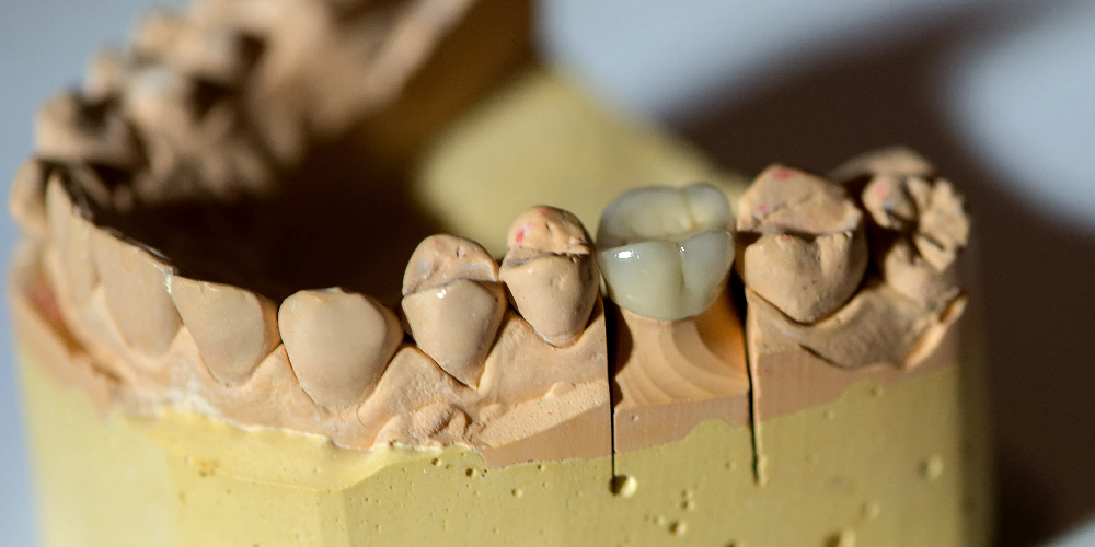 multilayer zirconia block