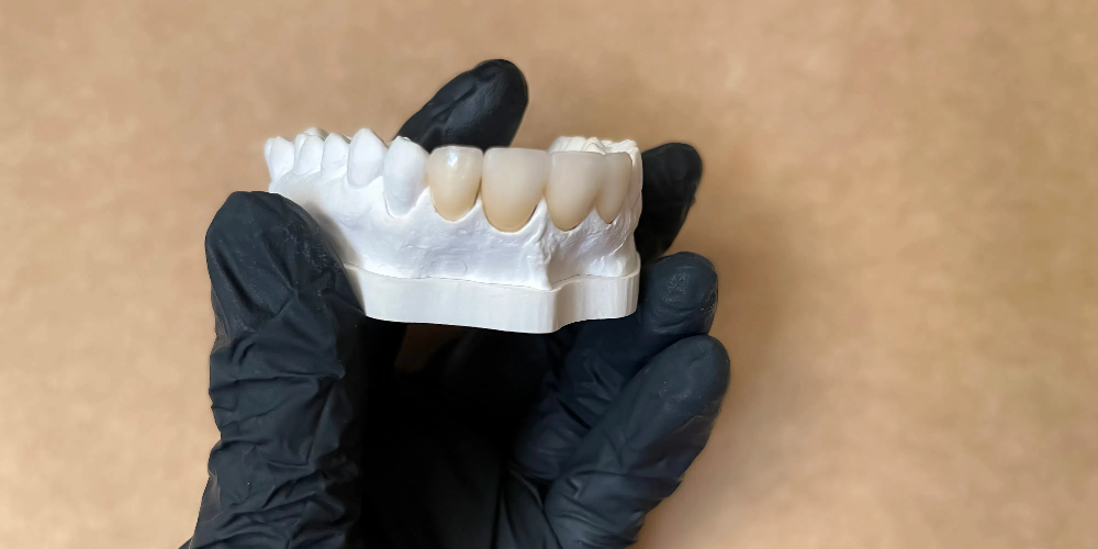 dental material